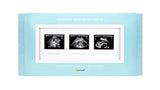 Pearhead Triple Sonogram Pregnancy Keepsake Frame, White