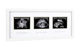 Pearhead Triple Sonogram Pregnancy Keepsake Frame, White